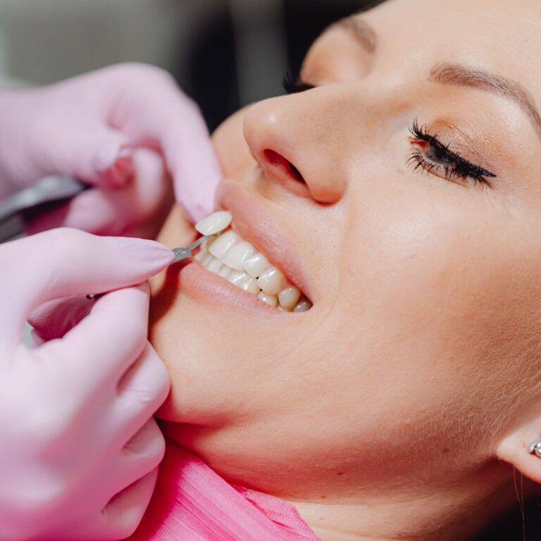 Tips to Extend the Longevity of Your Veneers CITIDental Boston